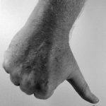 Setting Aside a Property Order for Duress